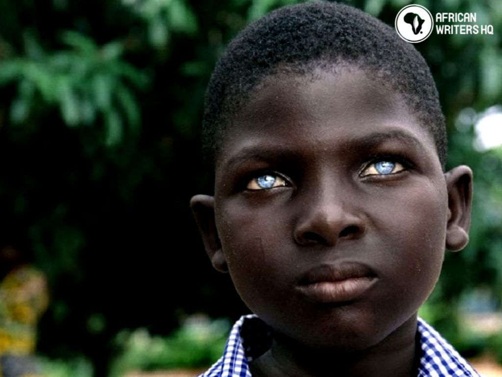 Blacks With Blue Eyes Origin, Myth And Everything You Need To Know